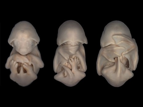 ecografiatridimensionales.jpg imágenes embrionarias.jpgmurcielago